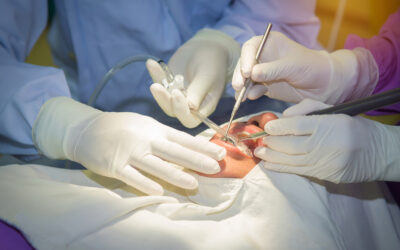 Preparing for Oral Surgery: What Patients Need to Know
